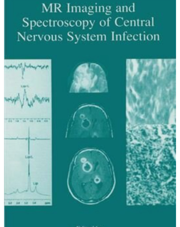 interventional MRI by Robert Lufkin