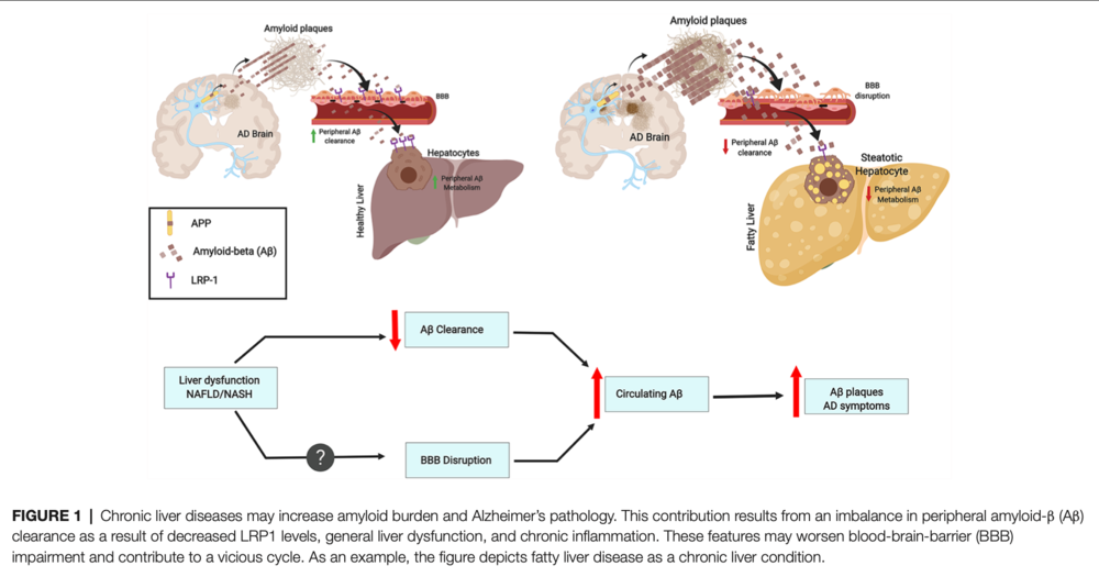 Estrada, Lisbell D., Pablo Ahumada, Daniel Cabrera, and Juan P. Arab. “Liver Dysfunction as a Novel Player in Alzheimer’s Progression: Looking Outside the Brain.” Frontiers in Aging Neuroscience 11 (July 17, 2019): 174. https://doi.org/10.3389/fnagi.2019.00174 . Frontiers in Aging Neuroscience