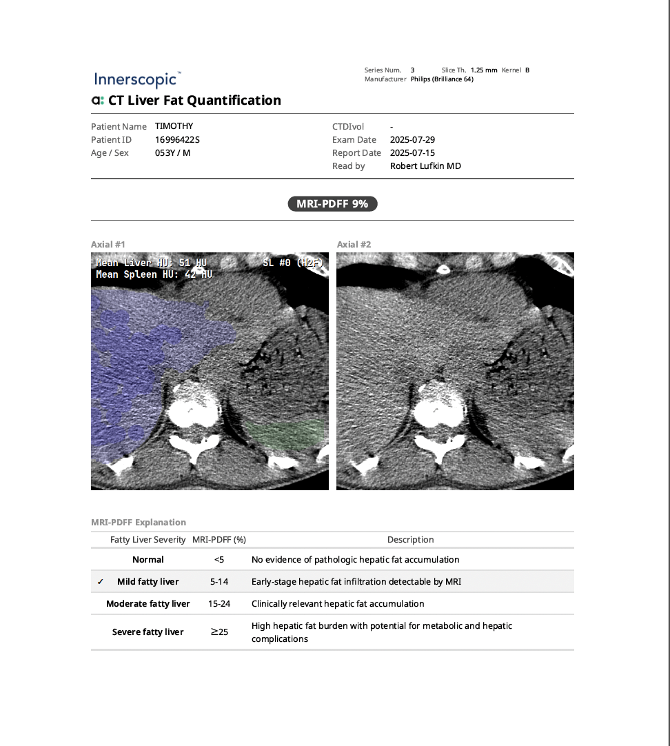CT LIVER SAMPLE