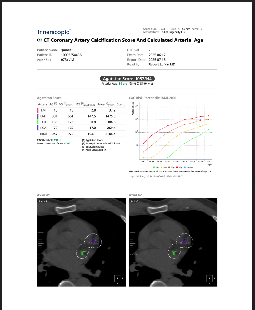 INNERSCOPIC CTCAC SAMPLE
