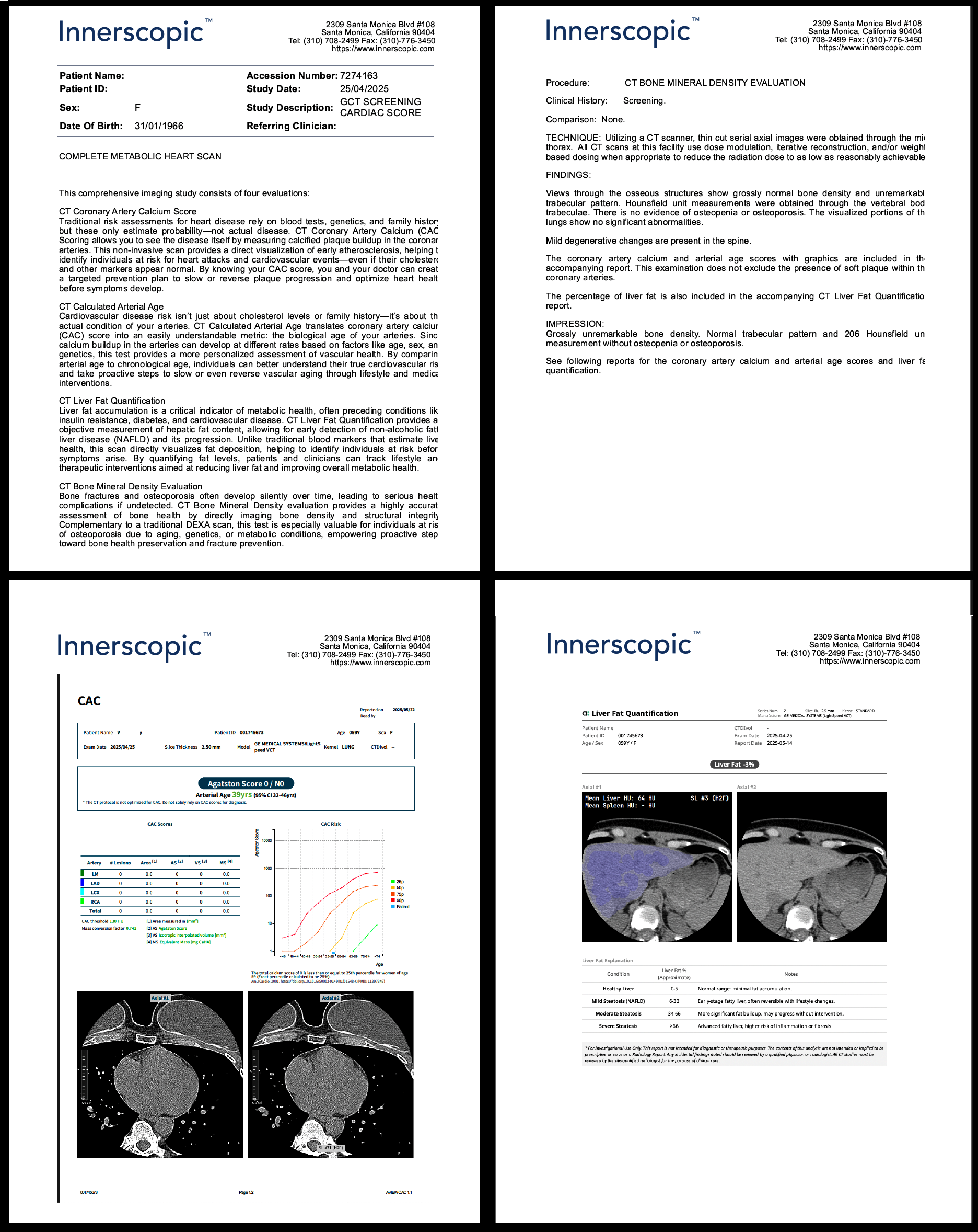 INNERSCOPIC 4x1